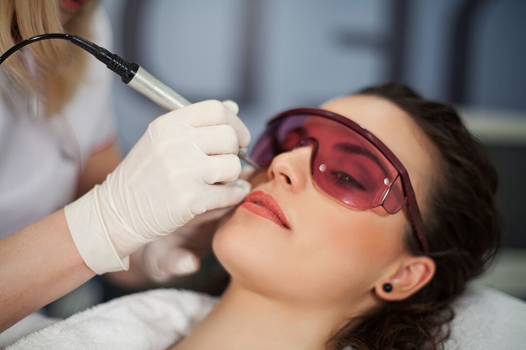 Laser Skin Rejuvenation