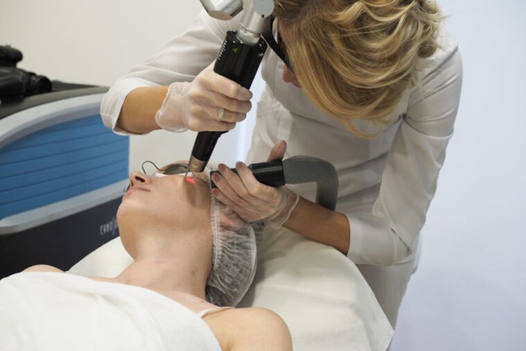 Laser skin rejuvenation