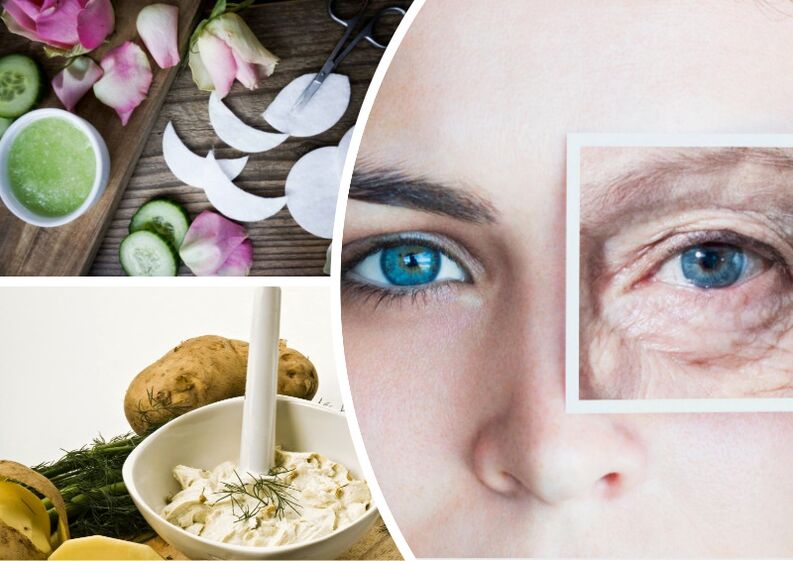 Skin running around eyes
