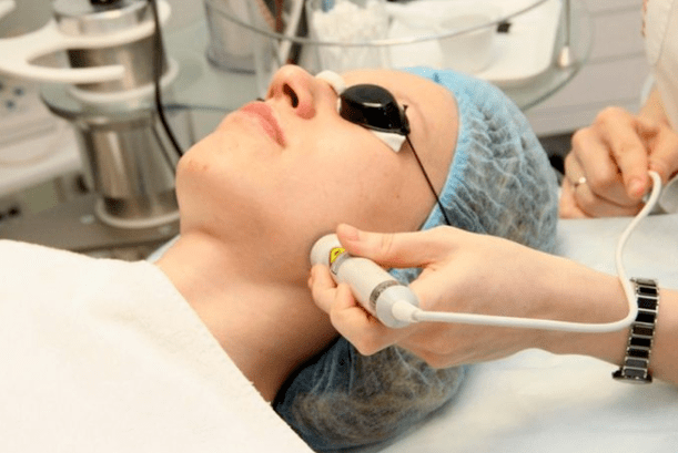 Laser bioactivation
