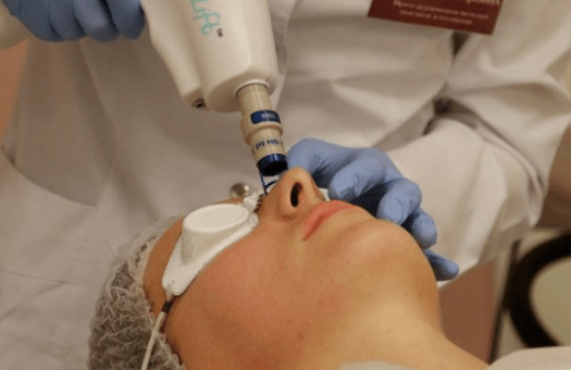 Laser rejuvenation is not available